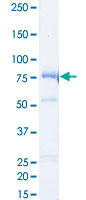 Loading 1 &mu;g protein in SDS-PAGE